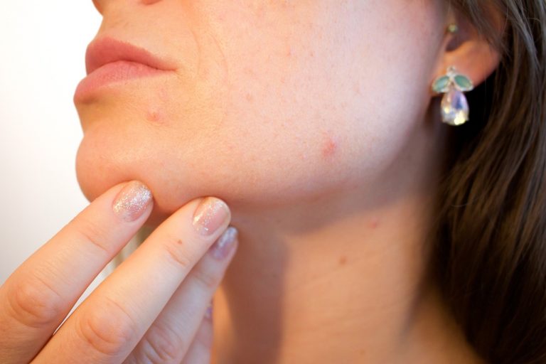 Zdrowie Skóry od A do Z: Porady od Profesjonalnego Dermatologa